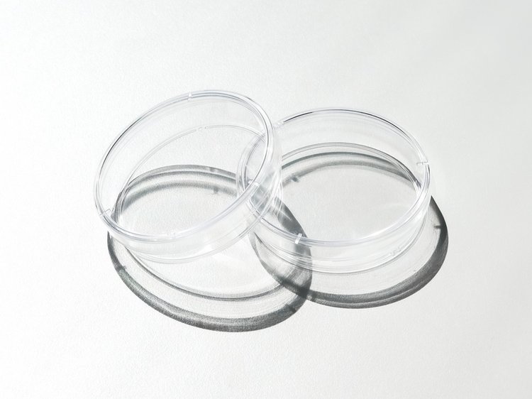 sperm retrieval winnipeg